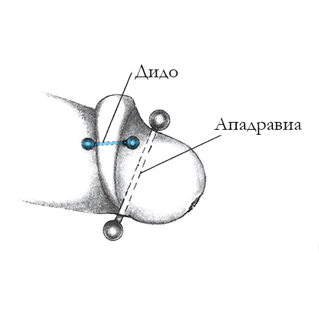 Интимный пирсинг "Дидо"